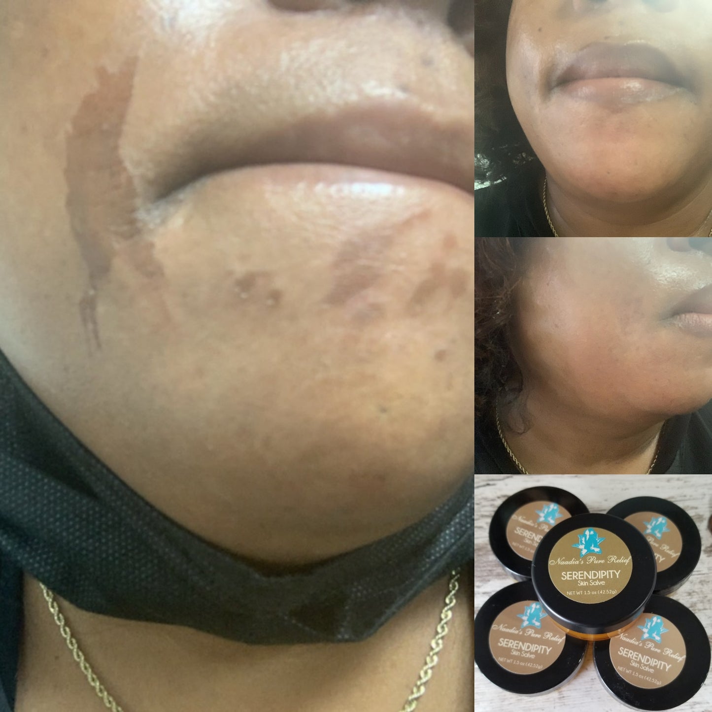 Serendipity Skin Salve (Abrasions, Burns, Diaper rash)