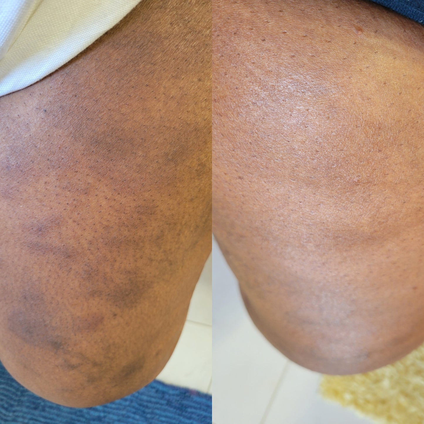 Serendipity Skin Salve (Abrasions, Burns, Diaper rash)