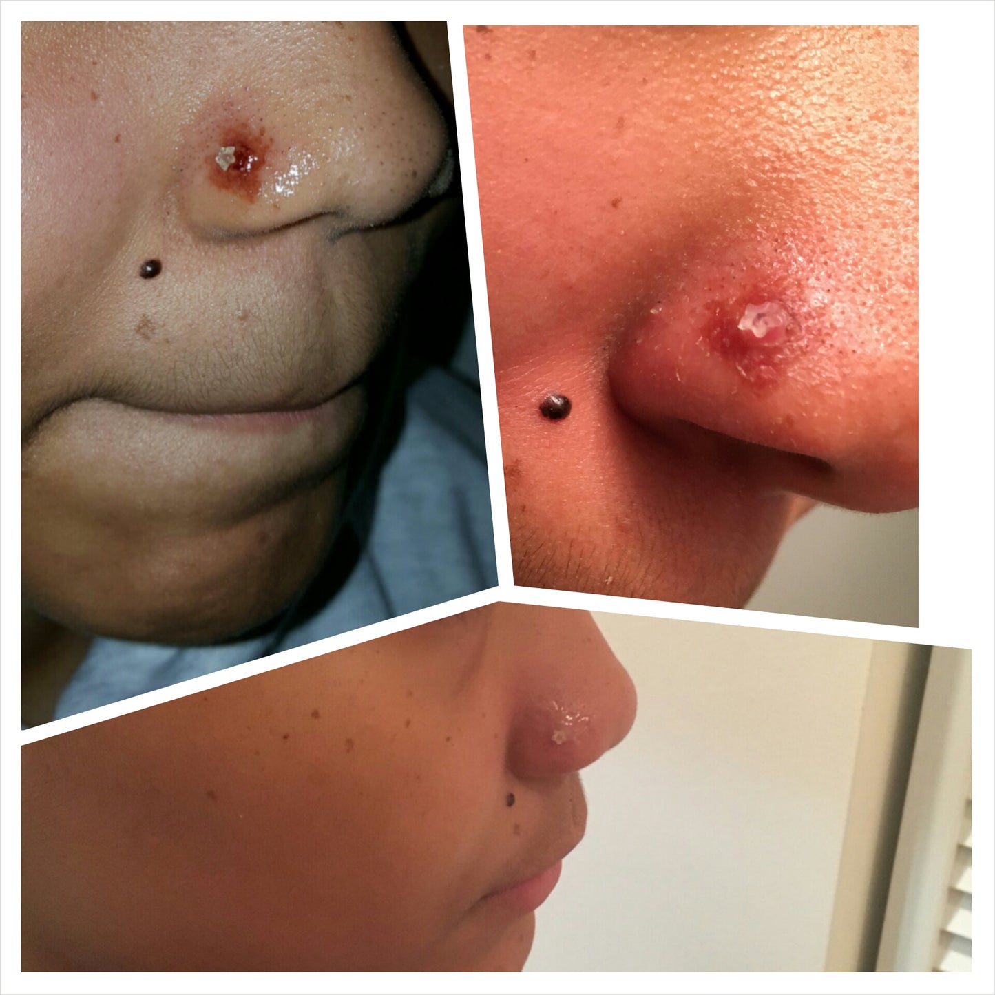 Serendipity Skin Salve (Abrasions, Burns, Diaper rash)